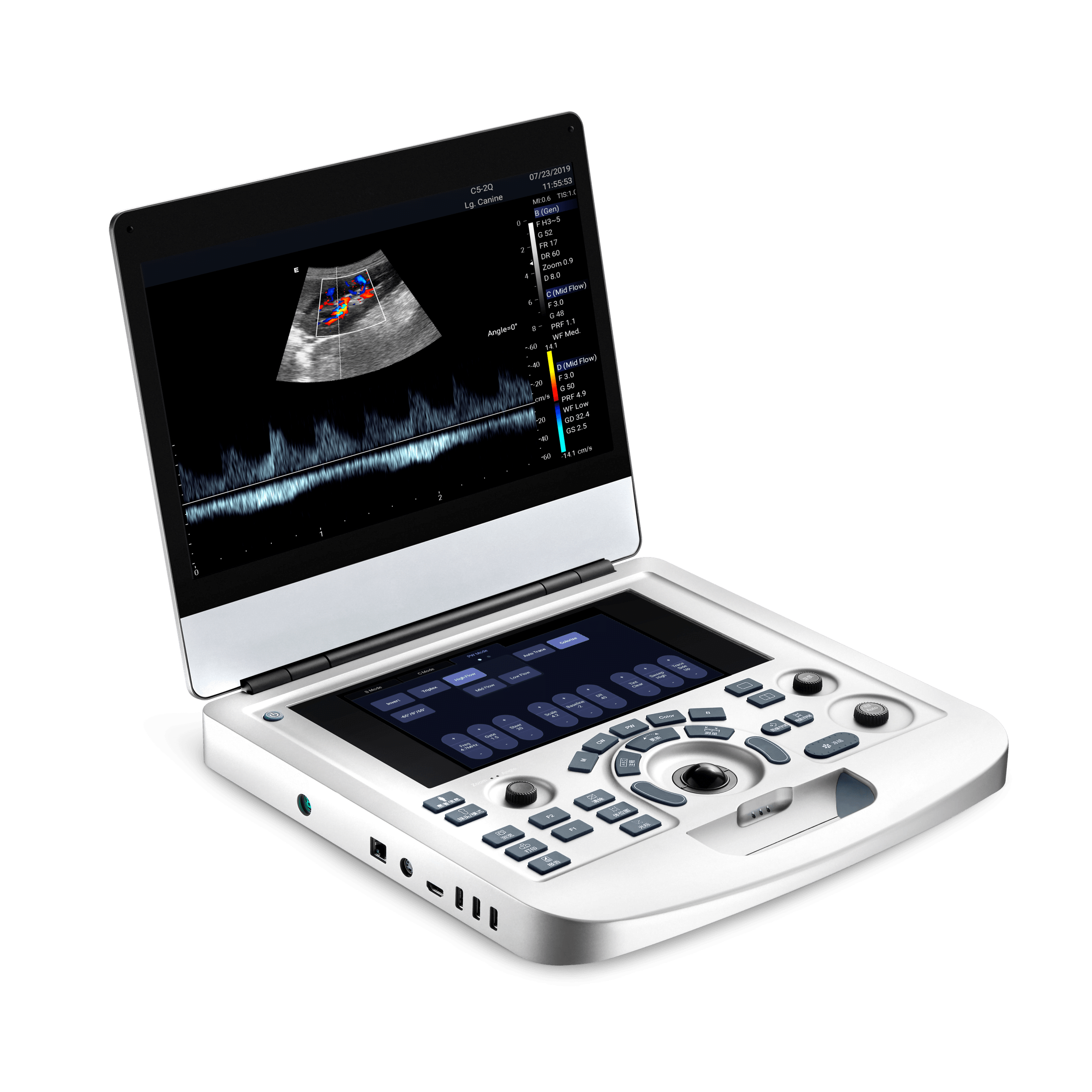Ultrassom AX2
